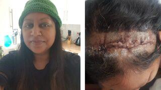 Görmezden gelmeyin! Yaşadığı kulak çınlamasını enfeksiyon sandı ama gerçekler bambaşkaydı...