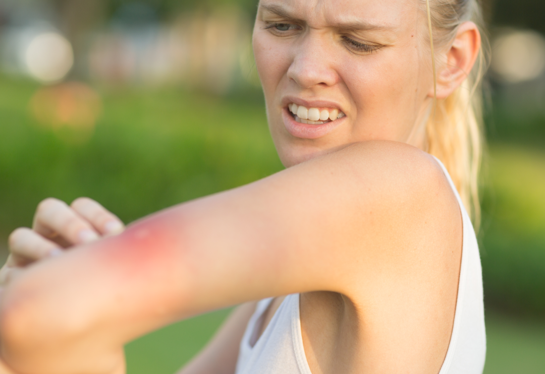 Son zamanlarda olduk&ccedil;a korkutuyor! Rahatsız edici sivrisineklerden uzak durmanızın yolu bunları yemekten ge&ccedil;iyor