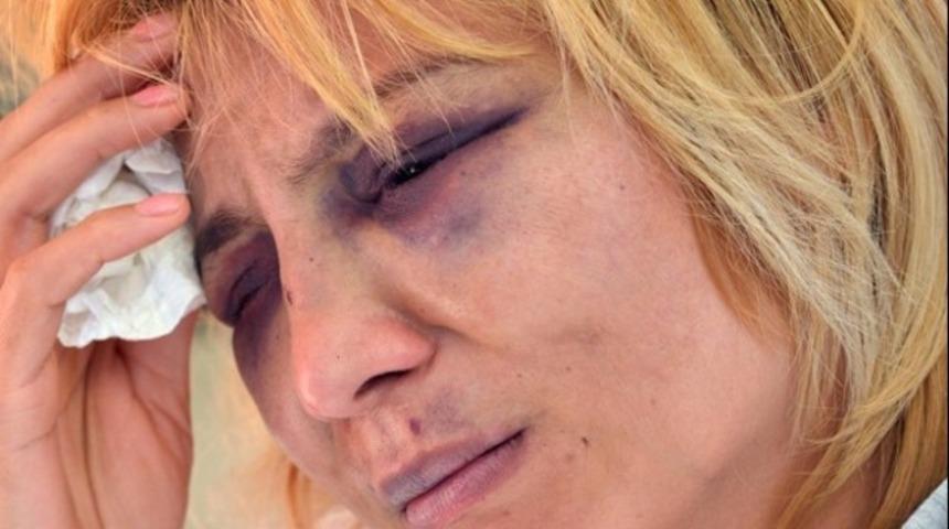 Bulaşığı makinede yıkadığı için eşini hastanelik etti