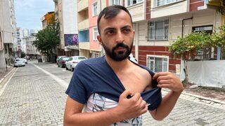 Borç verdiği parayı geri isteyince öldüresiye dayak yedi! 'Seni eşime şikayet edeceğim'