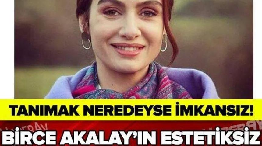 Birce Akalay'ın Estetiksiz Hali G&uuml;ndeme Bomba Gibi D&uuml;şt&uuml;!&eacute;