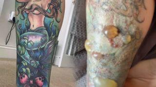 Yaptırmadan önce bir kez daha düşünün! Dövme sildirmenin bilinmeyen yüzü