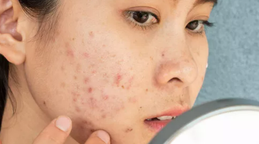 Cilt problemleri için cilt bakımınızı değiştirin! TikTok'ta trend olan 'Cilt Döngüsü' uygulamasıyla 20 yaş genç görünün