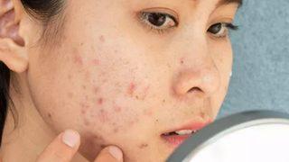 Cilt problemleri için cilt bakımınızı değiştirin! TikTok'ta trend olan 'Cilt Döngüsü' uygulamasıyla 20 yaş genç görünün