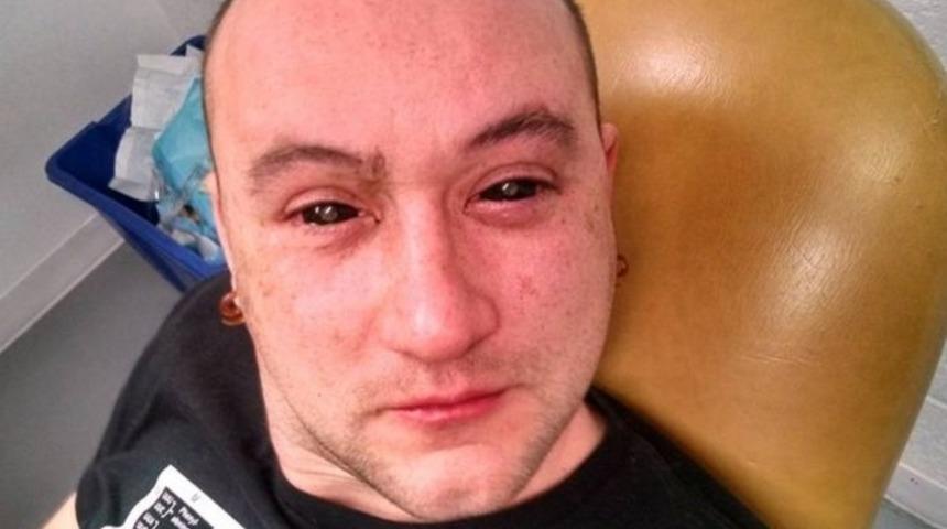 Süper kahraman olmak için gözüne yaptığına şok olacaksınız