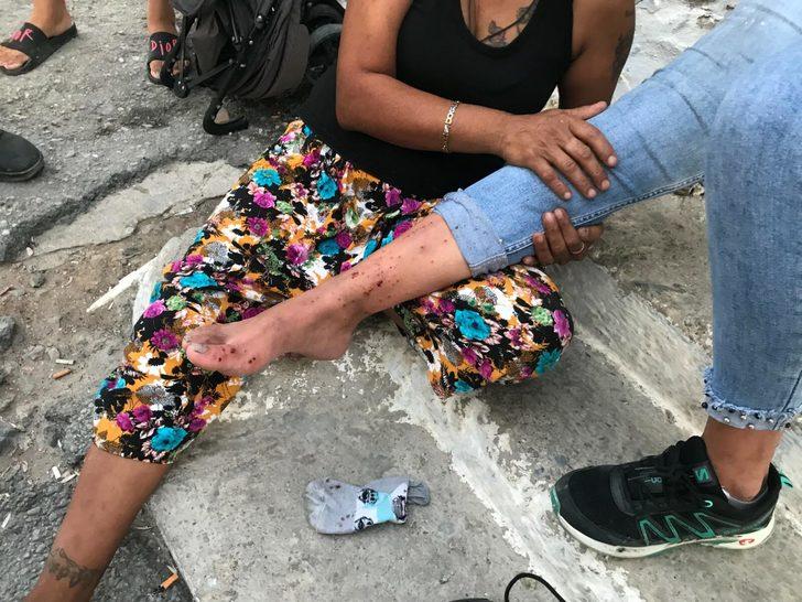 Pompalı tüfekle dehşet! Rastgele etrafa ateş açtı, bir mahalleyi yaraladı G2