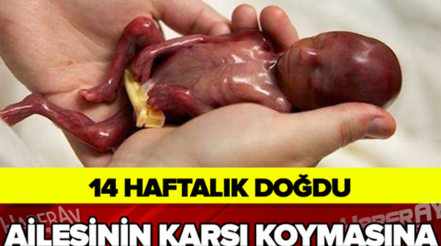 14 Haftalık Doğan Bebek Sosyal Medyayı Salladı Görenler ŞOK Oldu!