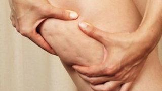 Anti-Selülit Diyeti