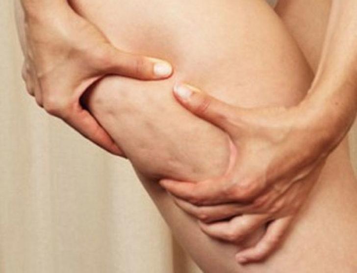 Anti-Sel&uuml;lit Diyeti