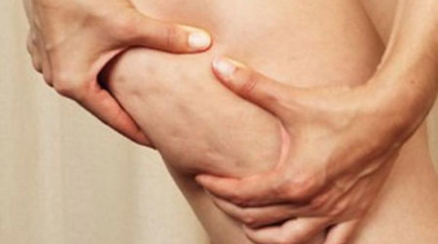 Anti-Sel&uuml;lit Diyeti