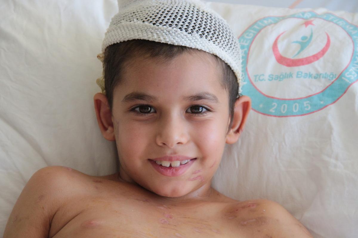 Sahipsiz k&ouml;peklerin saldırdığı k&uuml;&ccedil;&uuml;k Umut 24 g&uuml;n sonra taburcu edildi