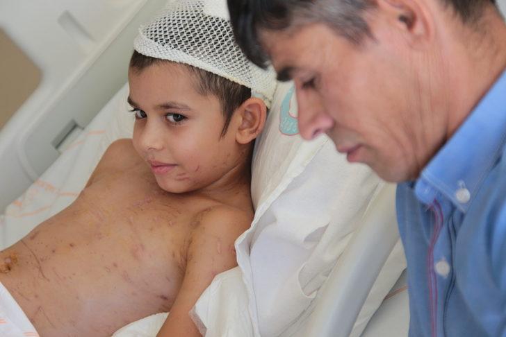 Sahipsiz köpeklerin saldırdığı küçük Umut 24 gün sonra taburcu edildi G2