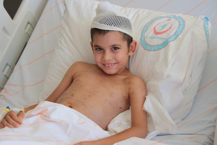 Sahipsiz köpeklerin saldırdığı küçük Umut 24 gün sonra taburcu edildi G5