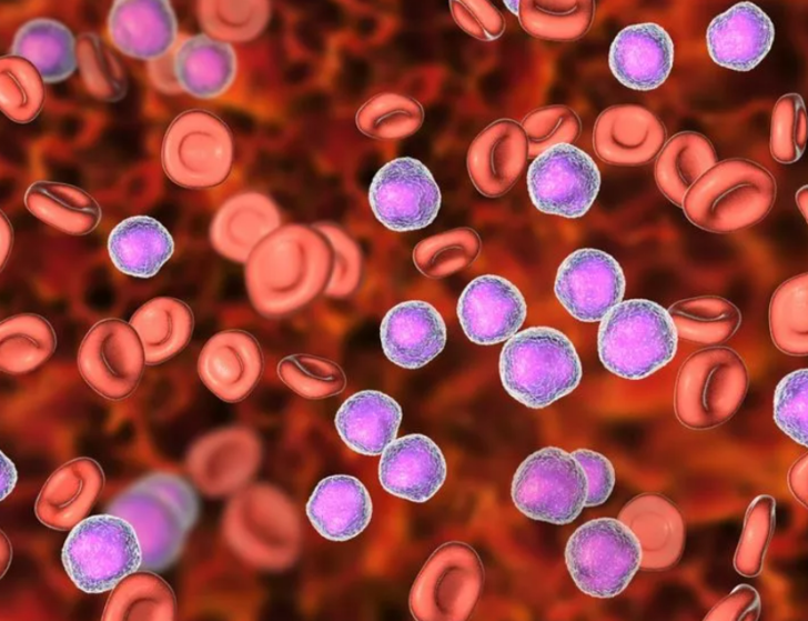 Terlemeniz sıcak havalardan kaynaklanmıyor olabilir! O tehlikeli hastalığın belirtisi... G1