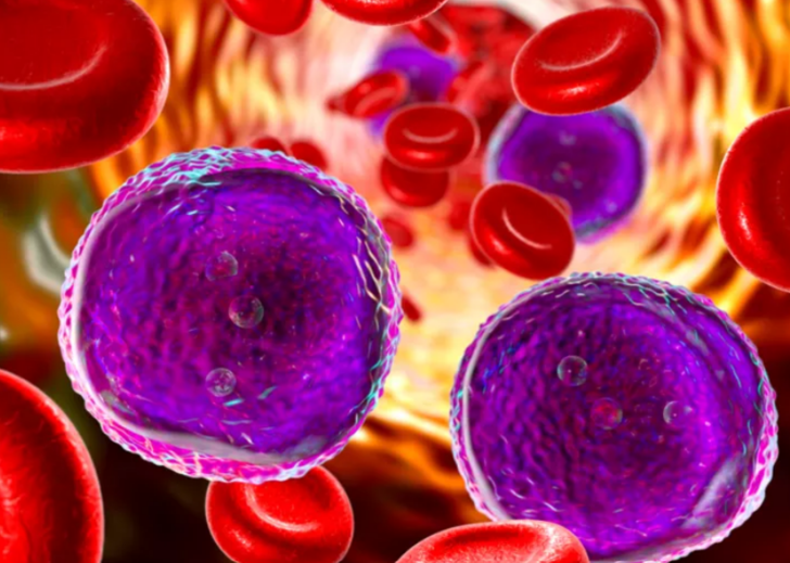 Terlemeniz sıcak havalardan kaynaklanmıyor olabilir! O tehlikeli hastalığın belirtisi... G4