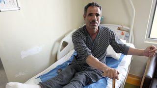 Felçli ayağı tandırda yanan adam bakın ne dedi!