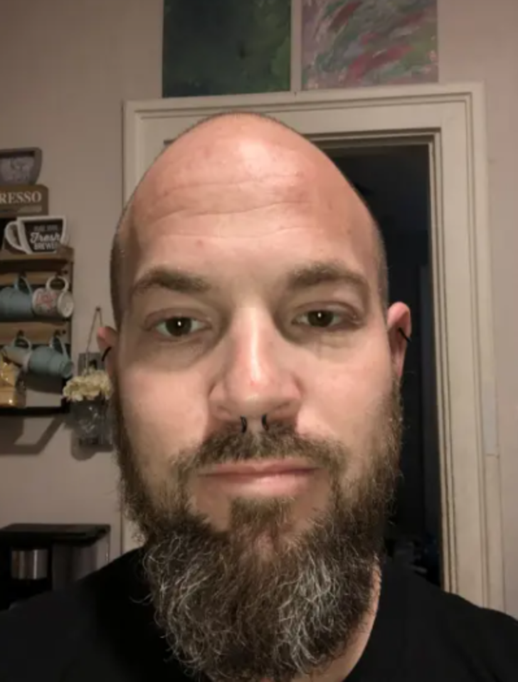 5 yıl önce burun piercingini kaybetti! Bulduğu yere kendisi bile inanamadı G1