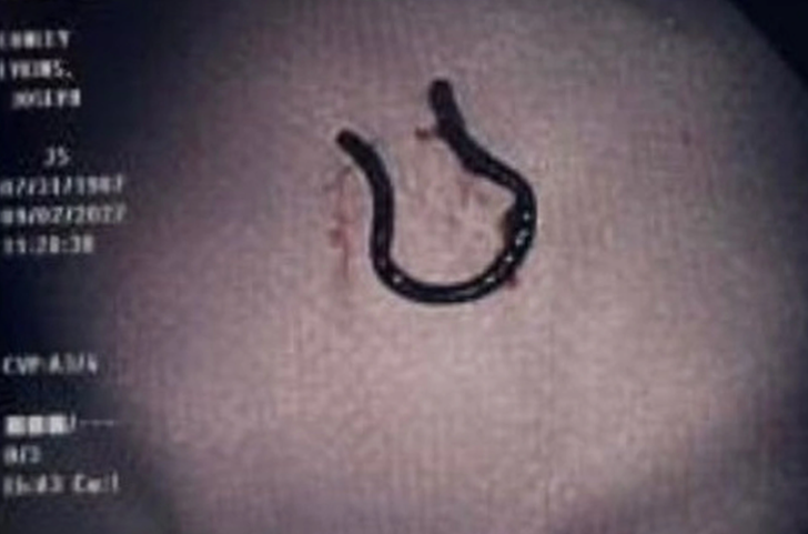 5 yıl önce burun piercingini kaybetti! Bulduğu yere kendisi bile inanamadı G3