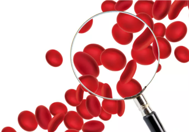 Uzmanlar uyarıyor: Bu kan grubuna sahip olanlar dikkat! Felç geçirme riskiniz çok daha fazla G2