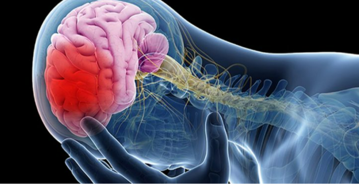 Uzmanlar uyarıyor: Bu kan grubuna sahip olanlar dikkat! Felç geçirme riskiniz çok daha fazla G3