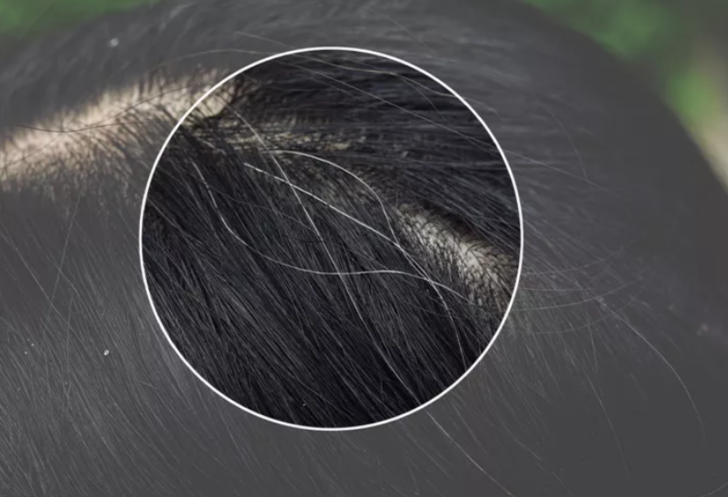 Erken yaşta bembeyaz yapıyor! Saçlarınızın beyazlamaması için bunlardan uzak durun G2