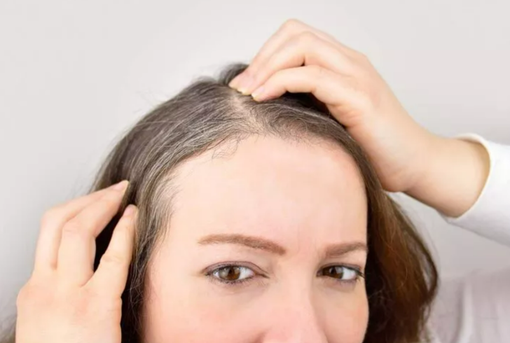 Erken yaşta bembeyaz yapıyor! Saçlarınızın beyazlamaması için bunlardan uzak durun G3