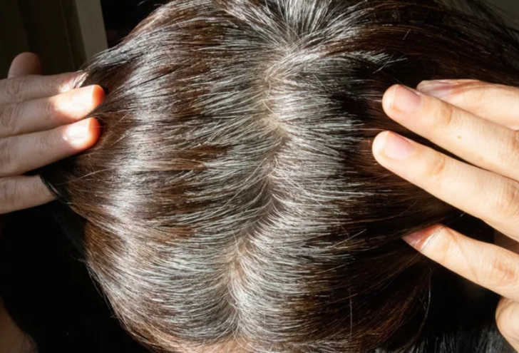 Erken yaşta bembeyaz yapıyor! Saçlarınızın beyazlamaması için bunlardan uzak durun G4