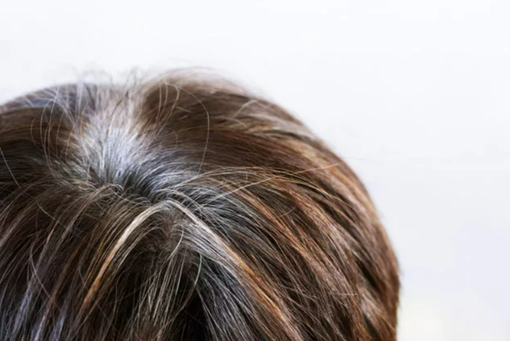 Erken yaşta bembeyaz yapıyor! Saçlarınızın beyazlamaması için bunlardan uzak durun G5