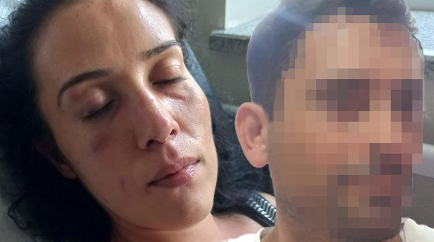 Dehşeti yaşattı! Eve çağırıp önce darp etti sonra da parmağını kesmeye çalıştı