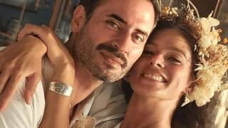 Özge Özpirinçci ve Burak Yamantürk evlilik yıl dönümlerini kutladı