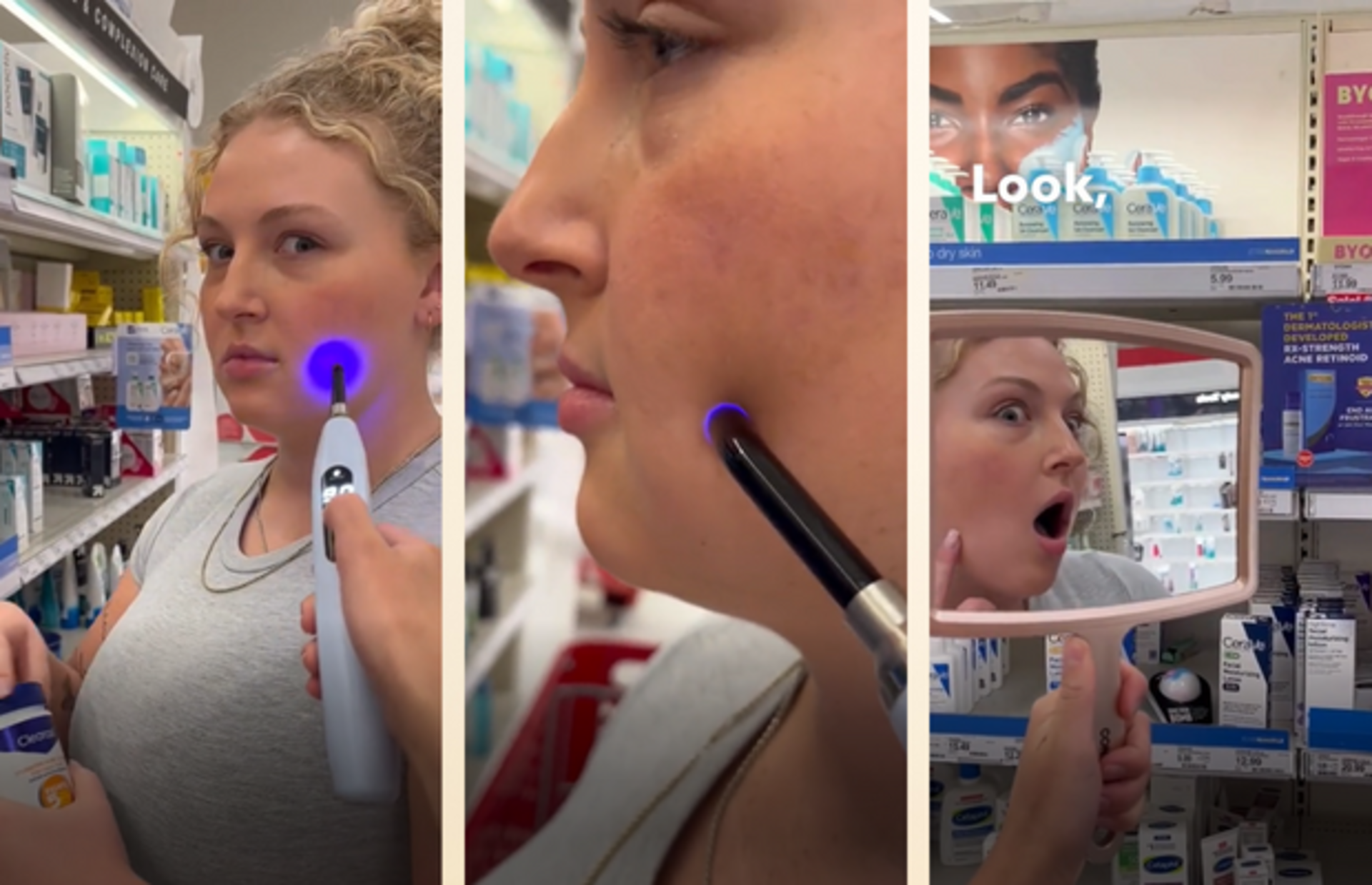 Sivilce izlerinizden çok kısa bir sürede kurtulmanızı sağlayacak iz giderici lazer cihazı