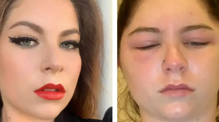 Sadece saçını boyamak istemişti! Başına gelenler aklınızın ucundan geçmez