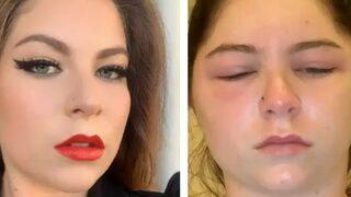 Sadece saçını boyamak istemişti! Başına gelenler aklınızın ucundan geçmez