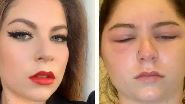 Sadece saçını boyamak istemişti! Başına gelenler aklınızın ucundan geçmez