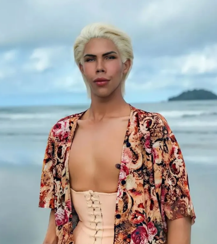 Yıllarca Barbie’nin sevgilisi ‘Ken Bebek’ gibi dolaştı! Şimdi tamamen tanınmaz halde G4