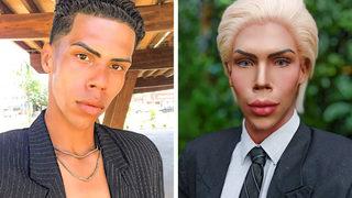 Yıllarca Barbie’nin sevgilisi ‘Ken Bebek’ gibi dolaştı! Şimdi tamamen tanınmaz halde