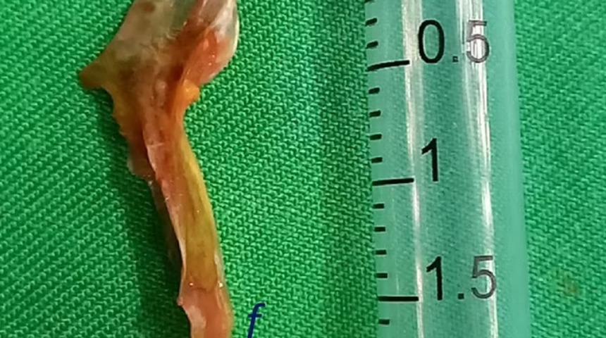 İşkencesi 3 gün sürdü! Ne olduğunu anlamadan öldü