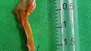 İşkencesi 3 gün sürdü! Ne olduğunu anlamadan öldü