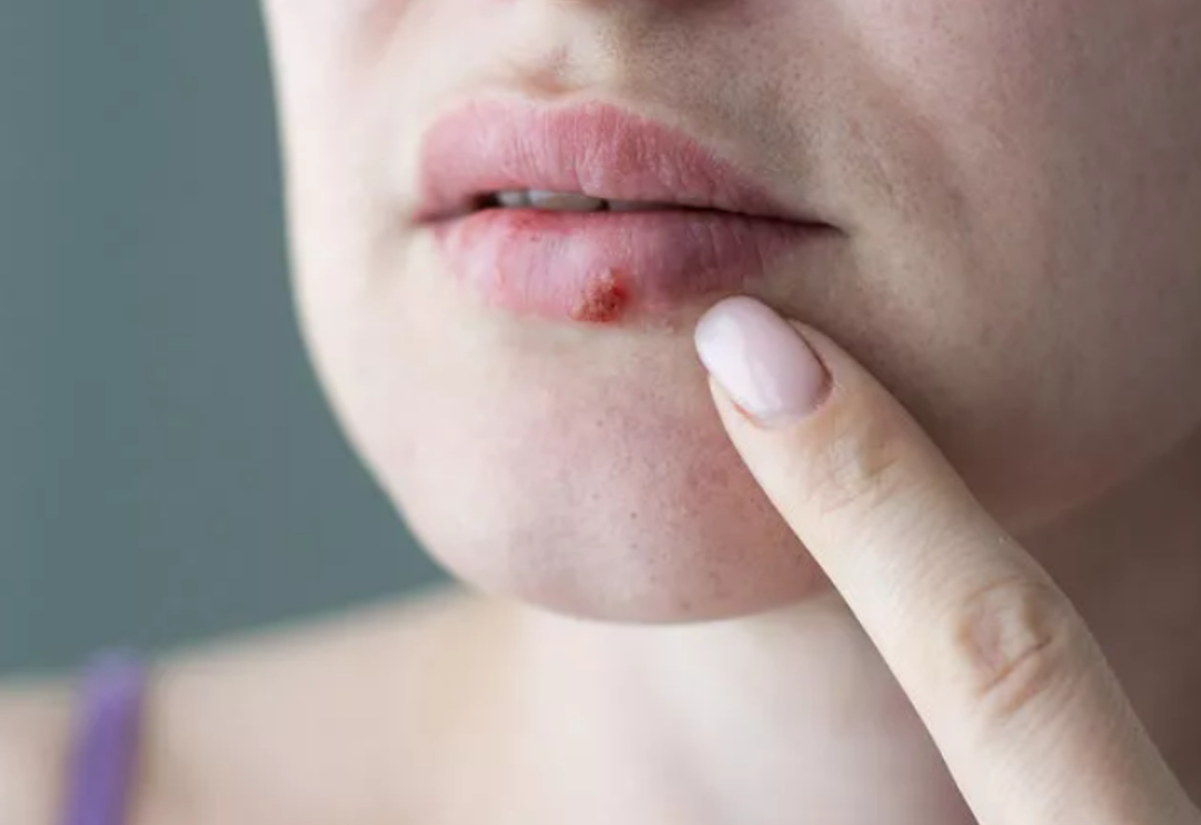 Bağışıklıklar d&uuml;şt&uuml; u&ccedil;uklar artmaya başladı! U&ccedil;uğu en kısa s&uuml;rede ge&ccedil;irmek i&ccedil;in etkili y&ouml;ntem