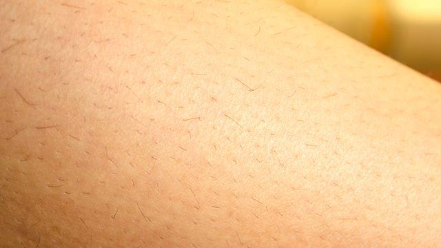 Sadece 2 malzeme ile istenmeyen tüylere kökten çözüm! Rusların yüzyıllardır uyguladığı bu tarifin etkileri inanılmaz