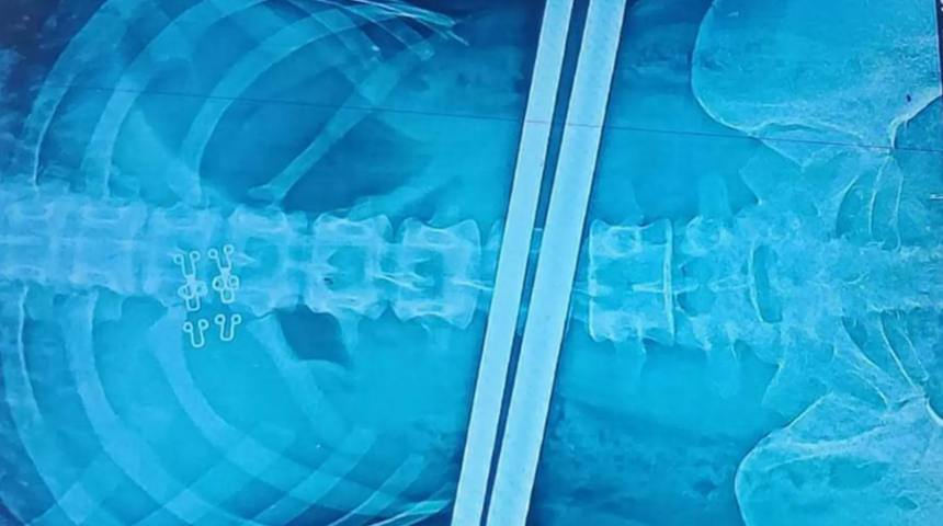 Dehşet verici! Maymun saldırısı nedeniyle çelik kazığa saplandı