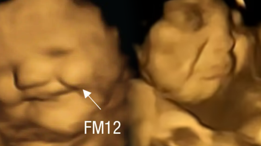 Çok şaşıracaksınız! Bu sebzeyi sevmemek anne karnında başlıyormuş