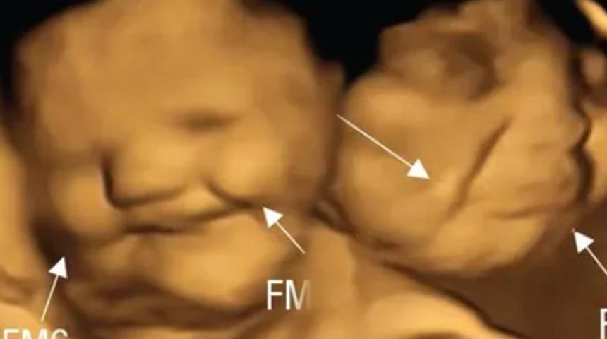 Anne karnında bile o yiyeceğin tadını beğenmediler! Fetüslerin yüzünü ekşittiği görüntüler gündem oldu