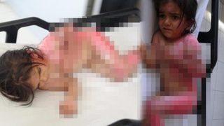 6 yaşındaki Songül'ün üzerine sıcak su kazanı devrildi