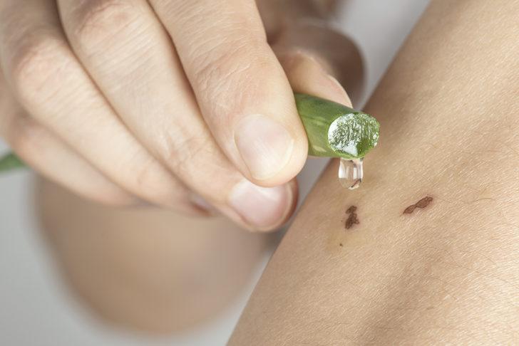 İlaçlara para vermeyin! Ne kaşıntı kalır ne leke: Egzamaya kökten çözüm! G2