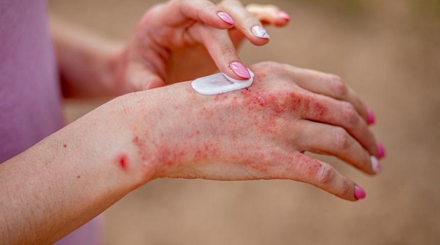 Bakmadan almayın: Zehirleniyorsunuz! Bünyeyi altüst ediyor