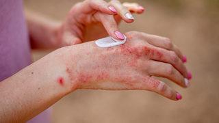 Bakmadan almayın: Zehirleniyorsunuz! Bünyeyi altüst ediyor