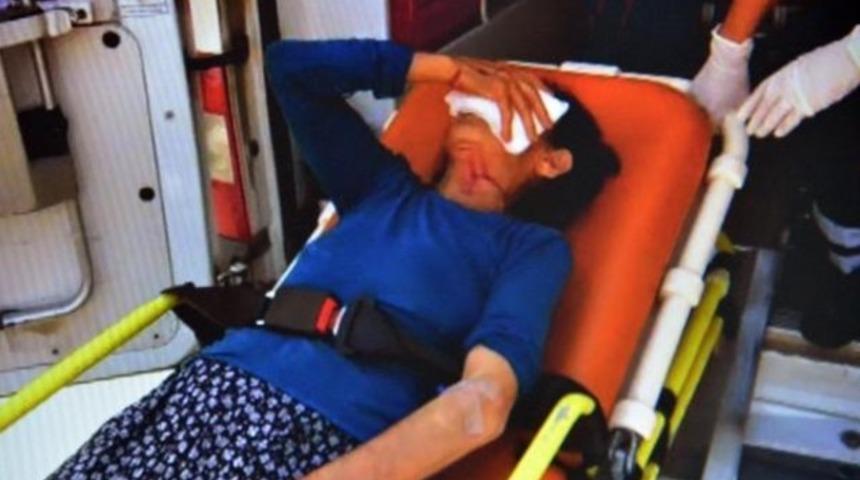 Boşanma davası s&uuml;ren eşini bı&ccedil;akladı, kayınvalidesini d&ouml;vd&uuml;