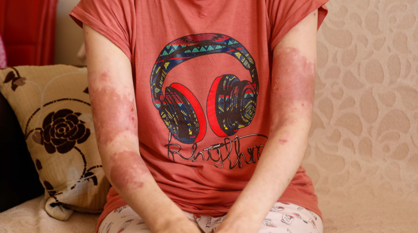 Eski elti dehşeti! Önce 17 kez bıçakladı, sonra kaynar suyla haşladı