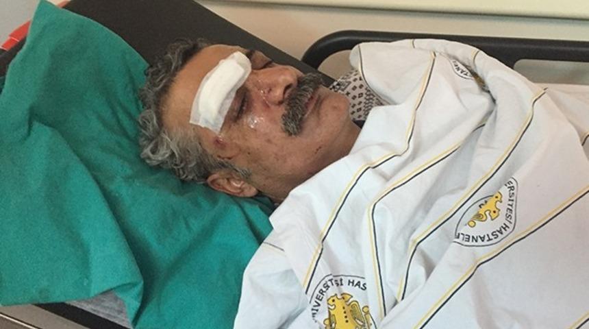 &Ccedil;iyager kimdir? &Ccedil;iyager feci şekilde d&ouml;v&uuml;ld&uuml;